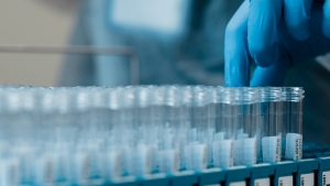 A genetic window on ‘All of Us’